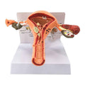 Life-Size Female Pathological Uterus Anatomy Model | Reproductive System Pathology & Disease Teaching Tool