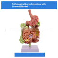 Life-Size Human Digestive System Anatomical Model | Gastric Coronal Section & Anorectal Anatomy Teaching Aid