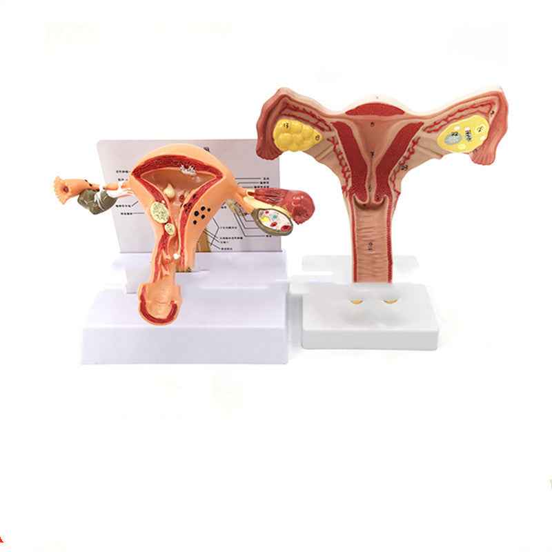 Life-Size Female Pathological Uterus Anatomy Model | Reproductive System Pathology & Disease Teaching Tool