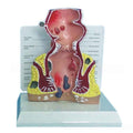 Life-Size Human Rectal and Anal Canal Anatomy Model – 1:1 Scale Medical Teaching & Patient Education Tool with Numbered Digital Indicator Signs