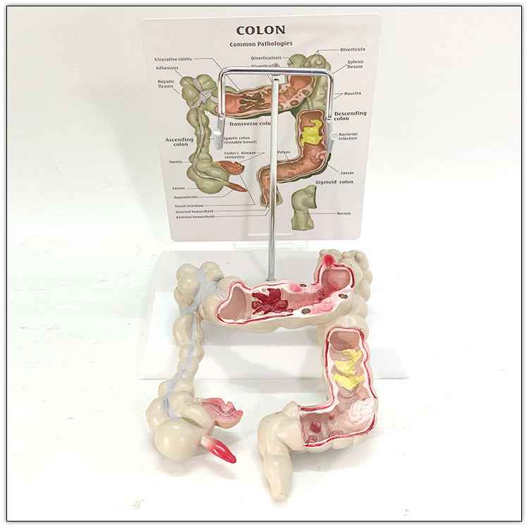 Life-Size Human Digestive System & Intestine Anatomy Model | 3D Medical Teaching Replica
