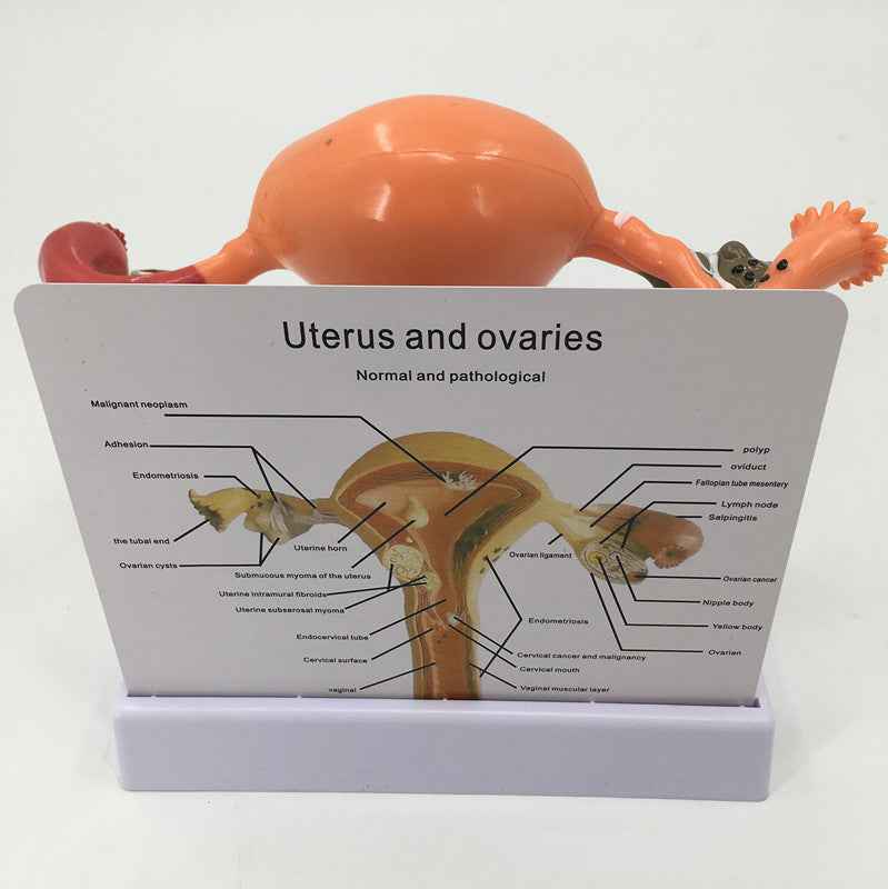Life-Size Female Pathological Uterus Anatomy Model | Reproductive System Pathology & Disease Teaching Tool