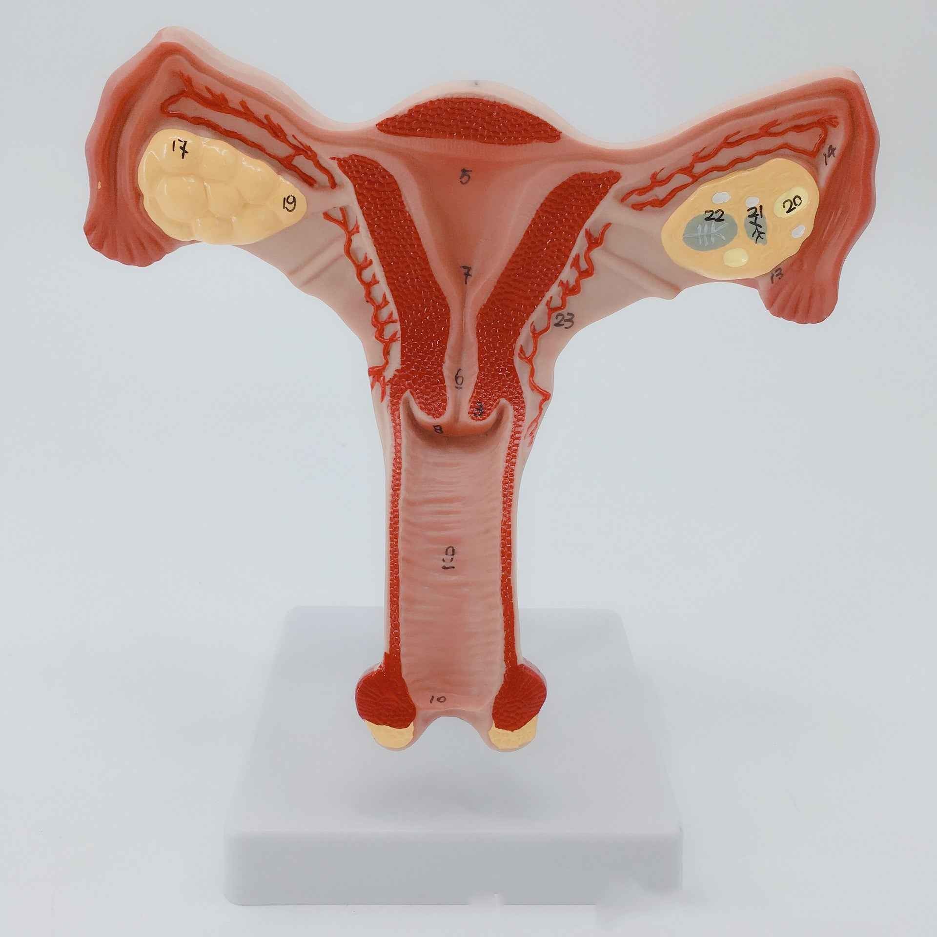 Life-Size Female Pathological Uterus Anatomy Model | Reproductive System Pathology & Disease Teaching Tool