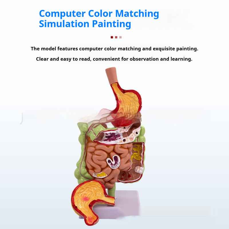 Life-Size Human Digestive System Anatomical Model | Gastric Coronal Section & Anorectal Anatomy Teaching Aid