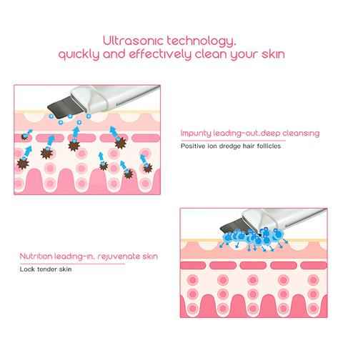 Ultrasonic Skin Scrubber & Blackhead Remover | Facial Cleansing Spatula