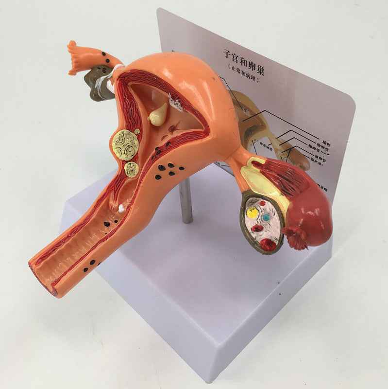 Life-Size Female Pathological Uterus Anatomy Model | Reproductive System Pathology & Disease Teaching Tool